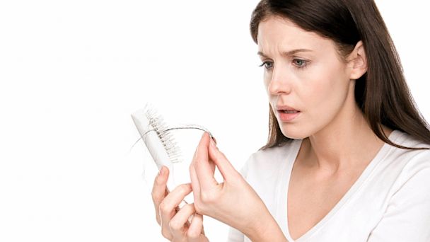 GTY_hair_loss_woman_nt_130828_16x9_608