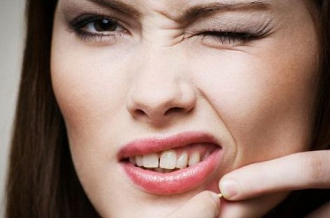 The best ideas to cure pimples within a short period