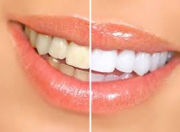 Natural ways to treat yellow teeth successfully