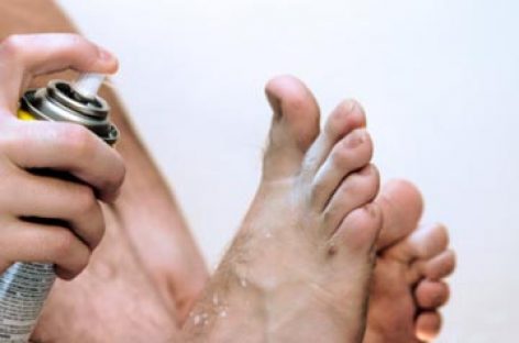 The well-known home remedies for athlete’s foot problems