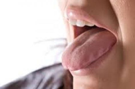 Home remedies for burning tongue