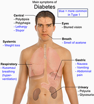 Diabetes_mellitus_body_layout