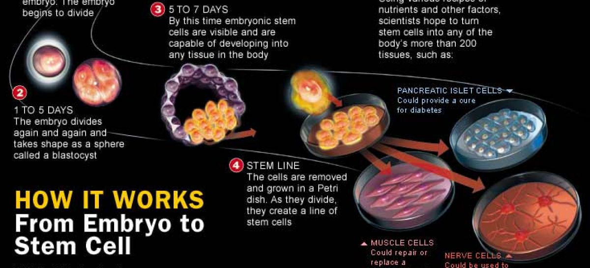 Stem Cells Therapy: The new hope for healing degenerative diseases