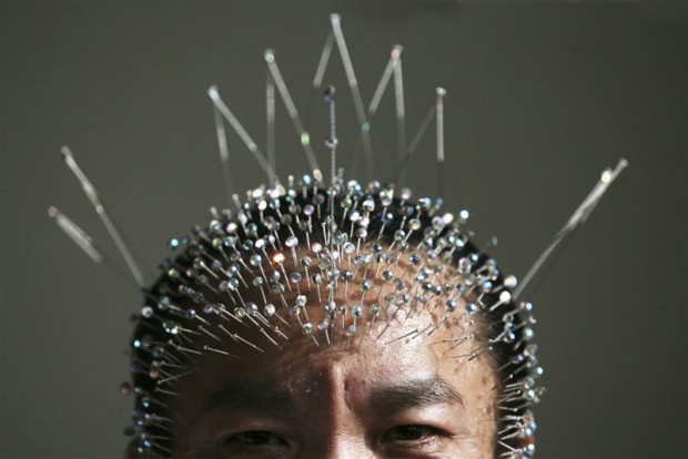 acupuncture-e1327457257385