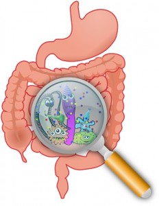 Inflammatory Bowel Disease