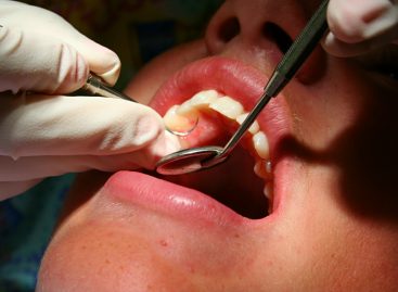 Dental cleaning is an important part of tooth maintenance