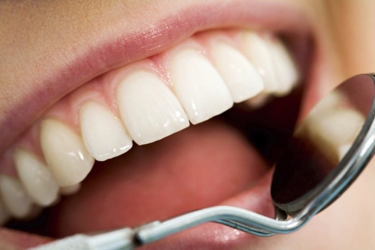 Mouth checkup