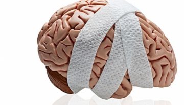 Concussion Rates Are on the Rise for Kid