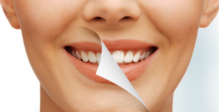 Cosmetic Dentistry