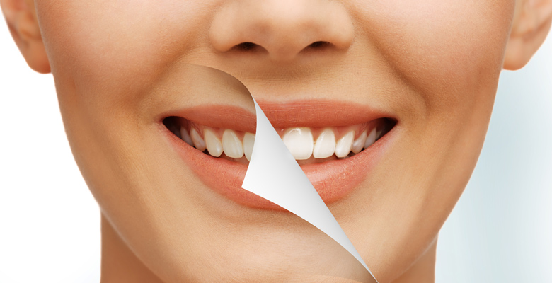 Cosmetic Dentistry