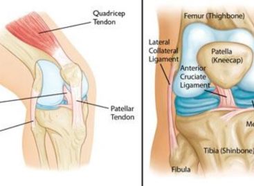 3 Common Knee Injuries