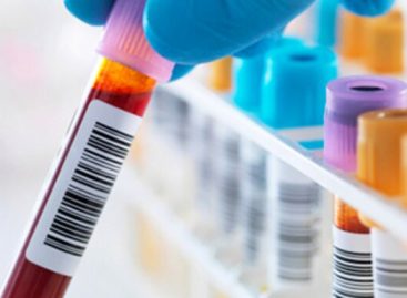 Facts About Basic Blood Testing