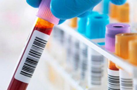 Facts About Basic Blood Testing