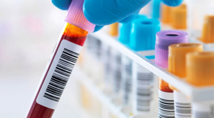 Basic Blood Testing1