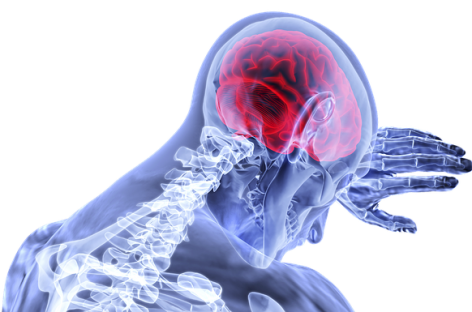Discover how physical therapist helps you recover from traumatic brain injury