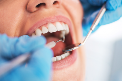 4 Reasons You Should Make Dental Health a Priority