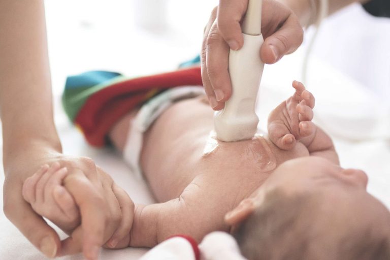 Congenital Heart Disease