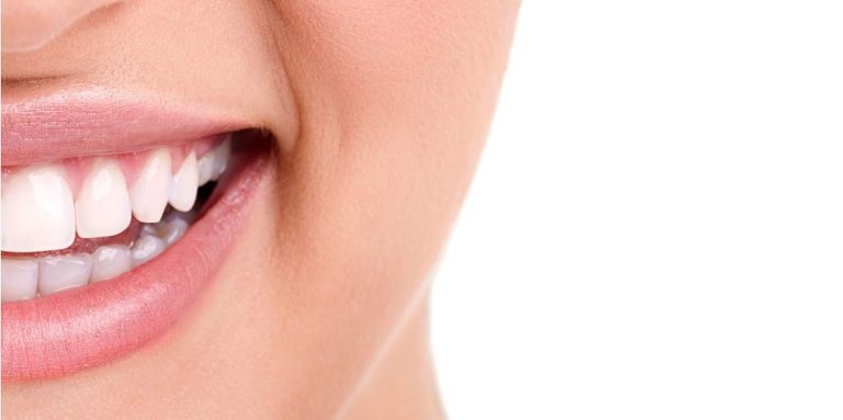 Improve Your Smile
