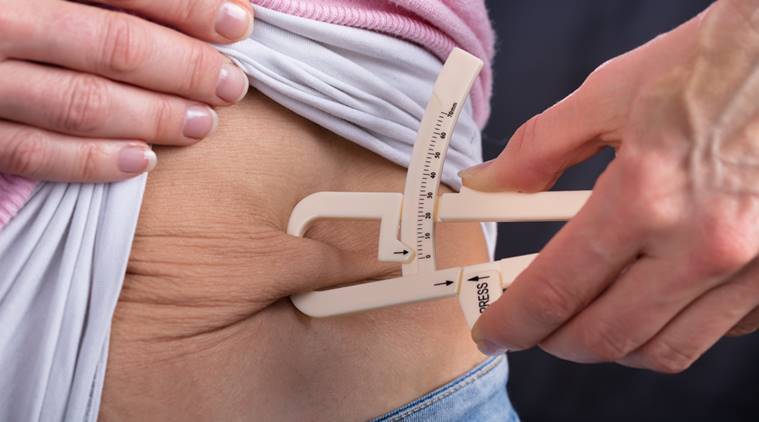 Weight Loss Surgery
