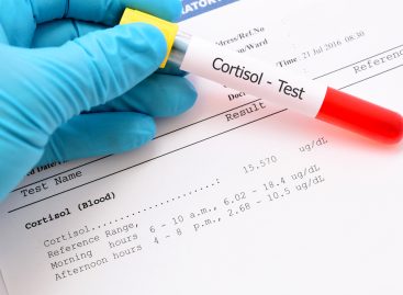 Reasons to Take an at-Home Saliva Cortisol Test