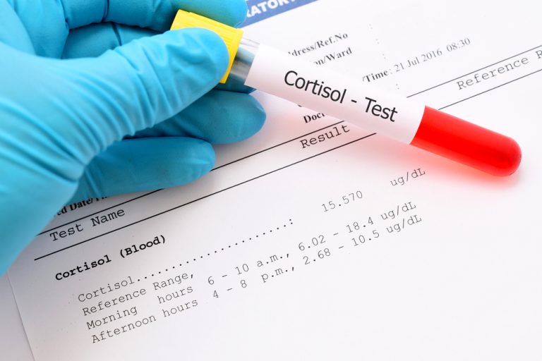 Saliva Cortisol Test