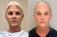 A Journey Through Time: How Plastic Surgery Has Evolved Over the Decades